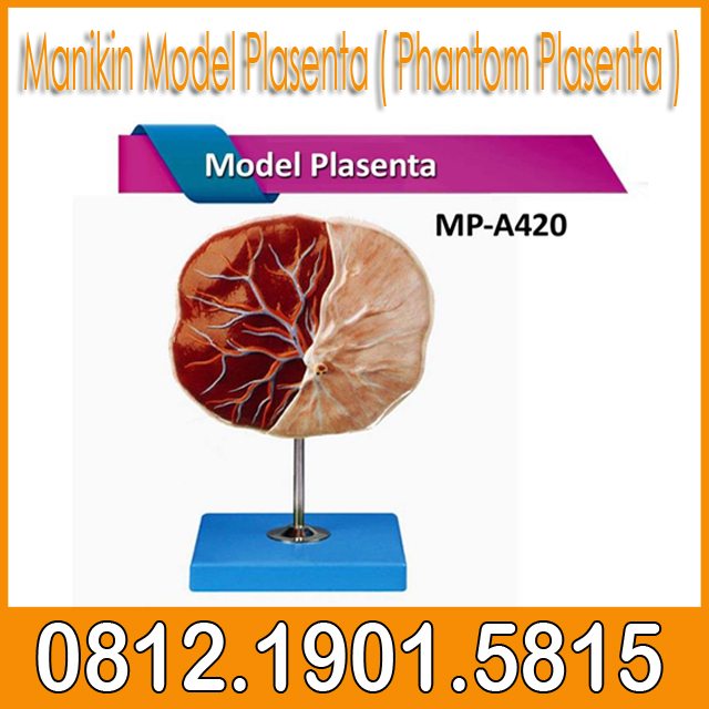 Manikin Model Plasenta ( Phantom Plasenta )