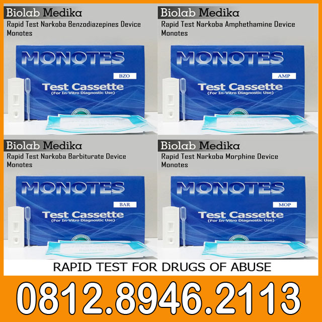 Rapid Test For Drugs Of Abuse