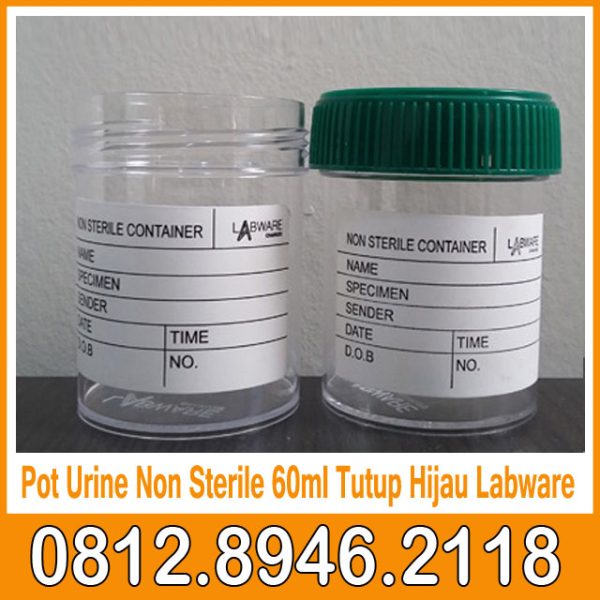 Pot Urine Non Sterile 60ml Tutup Hijau Labware