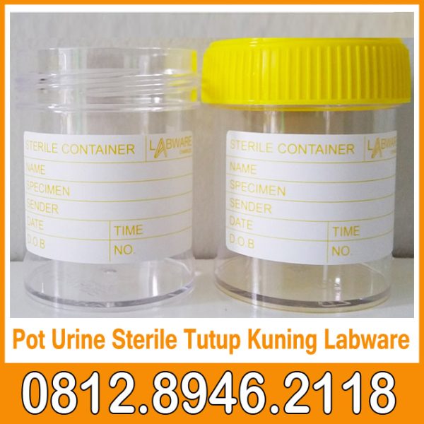 Pot Urine Sterile Tutup Kuning Labware